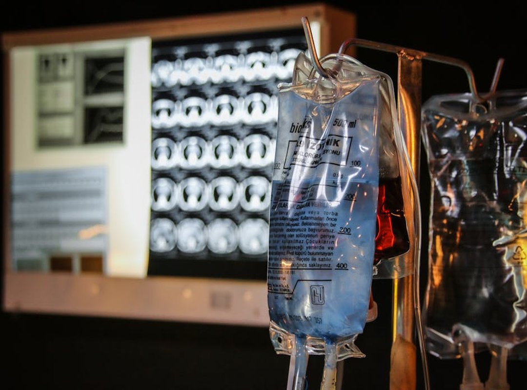 How to Use Authentic IV Arm Images Effectively